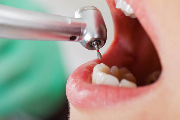 Best Emergency Dental Services for Seniors in Hightstown, NJ